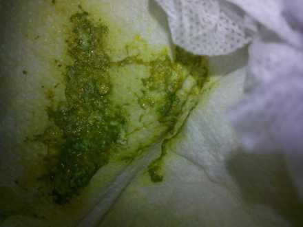 新生儿20天连续两天拉绿色便便怎么回事