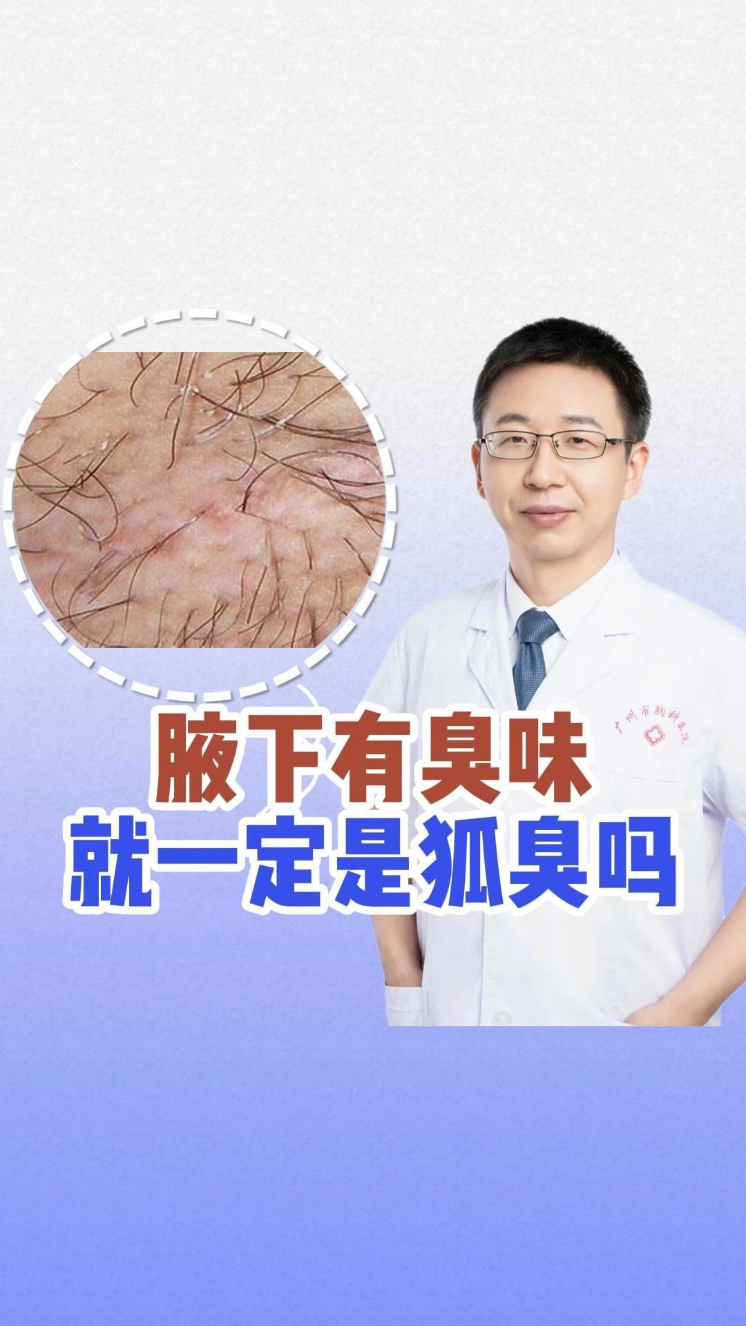 狐臭是啥味的..