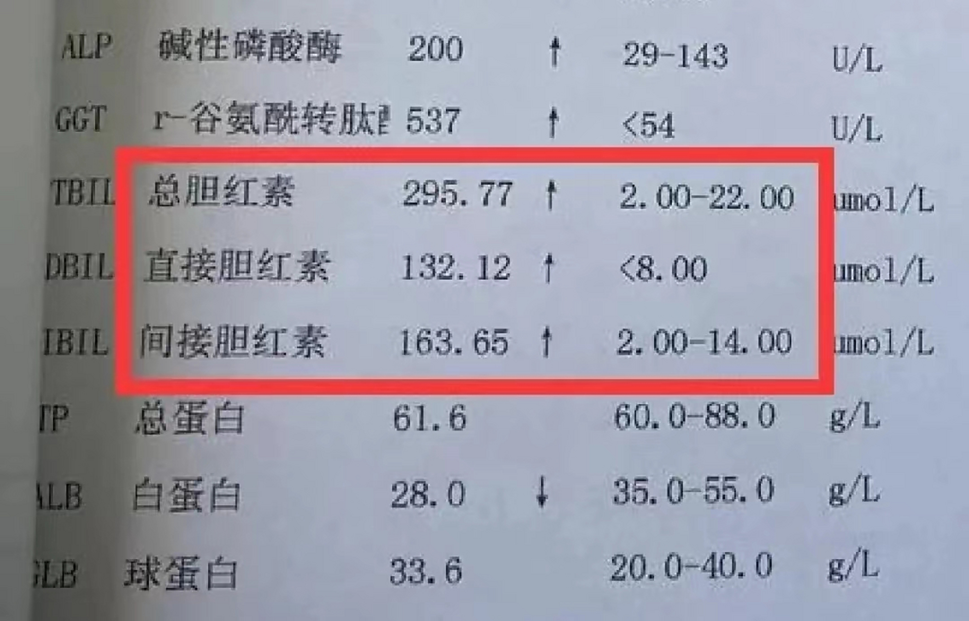 碱性磷酸酶升高是肝炎吗