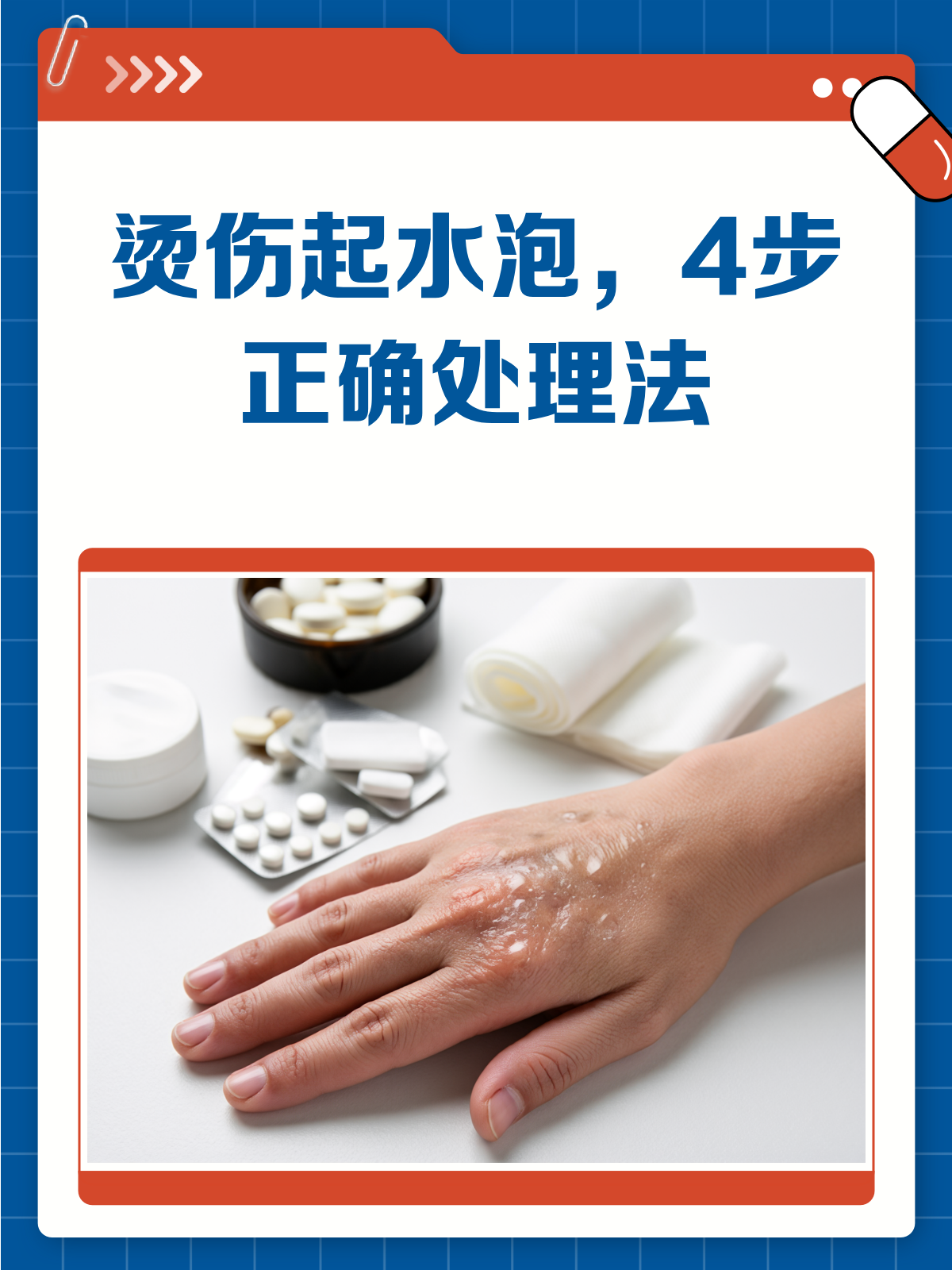 烫伤起水泡怎么办?