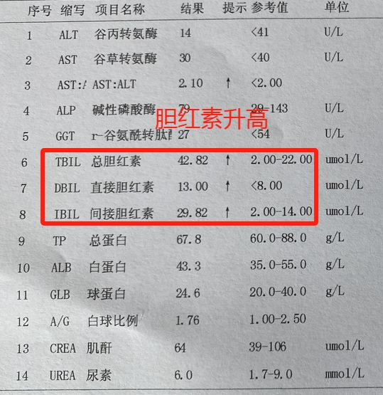 血清中的直接胆红素偏低