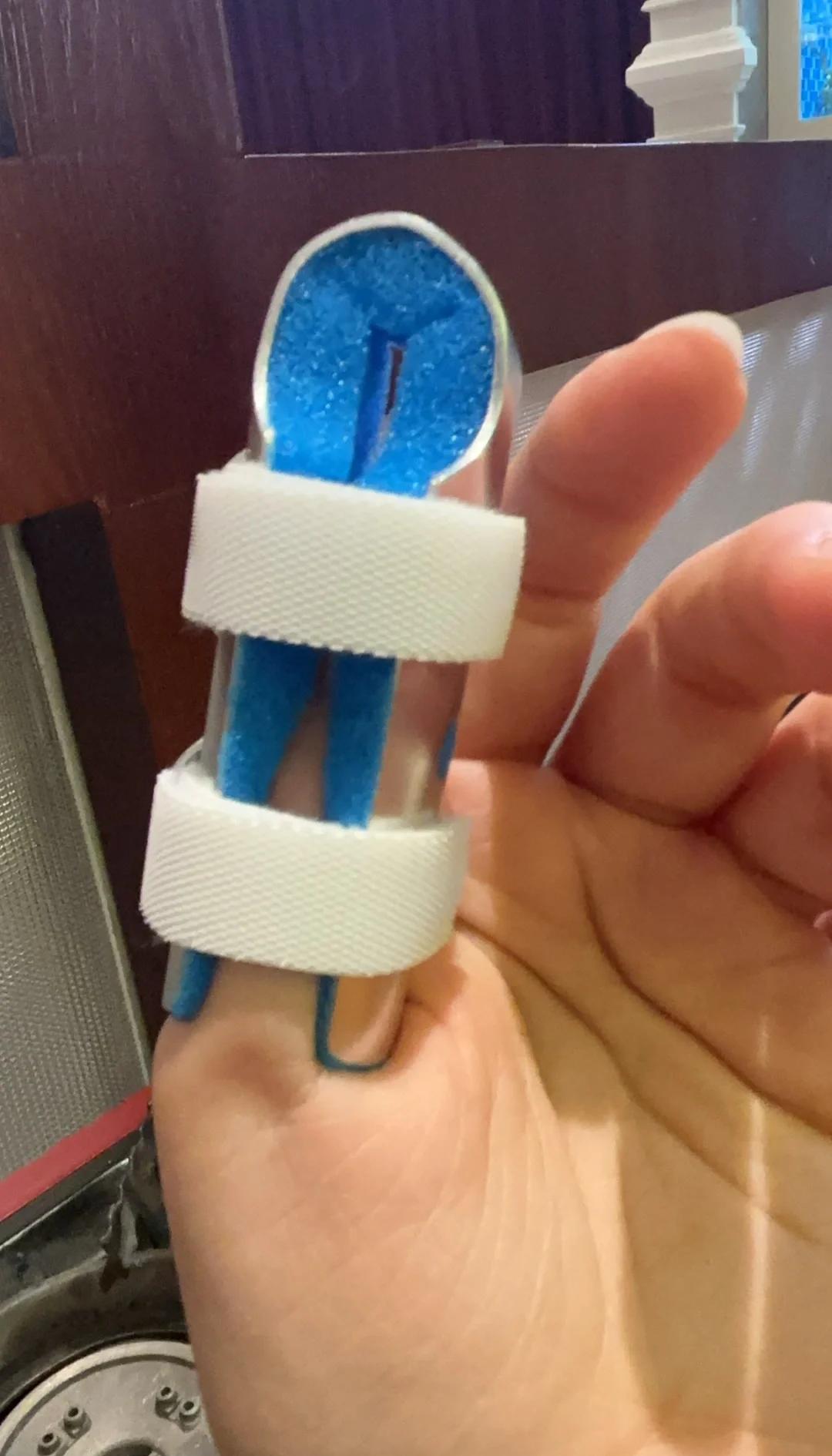 手指被门夹了,怎么办?