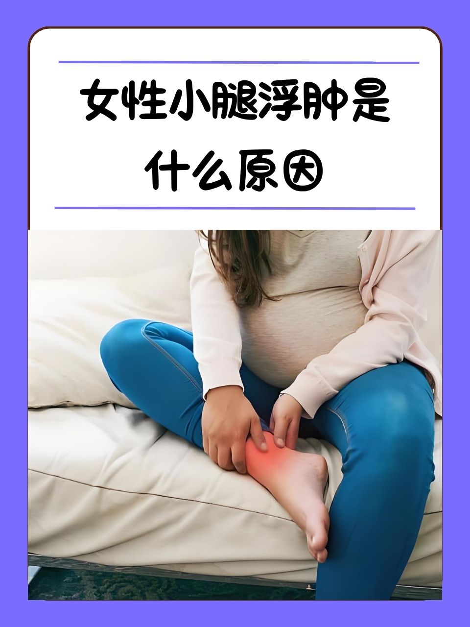 两腿肿是怎么回事