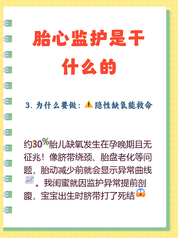 胎心监测多少周开始做