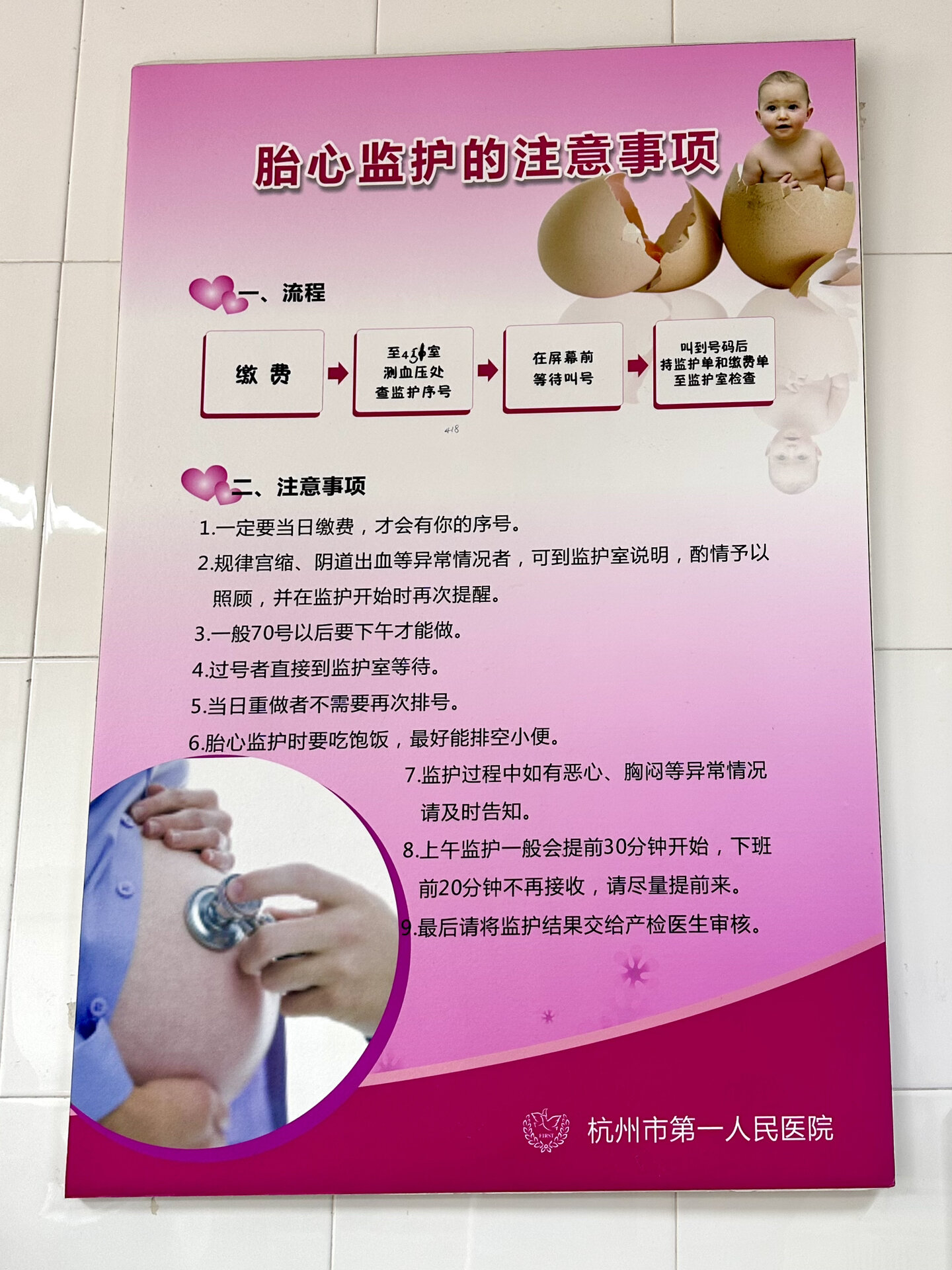 胎心监测多少周开始做