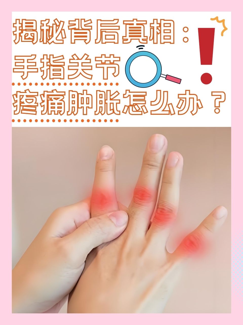 手指关节变大是怎么回事