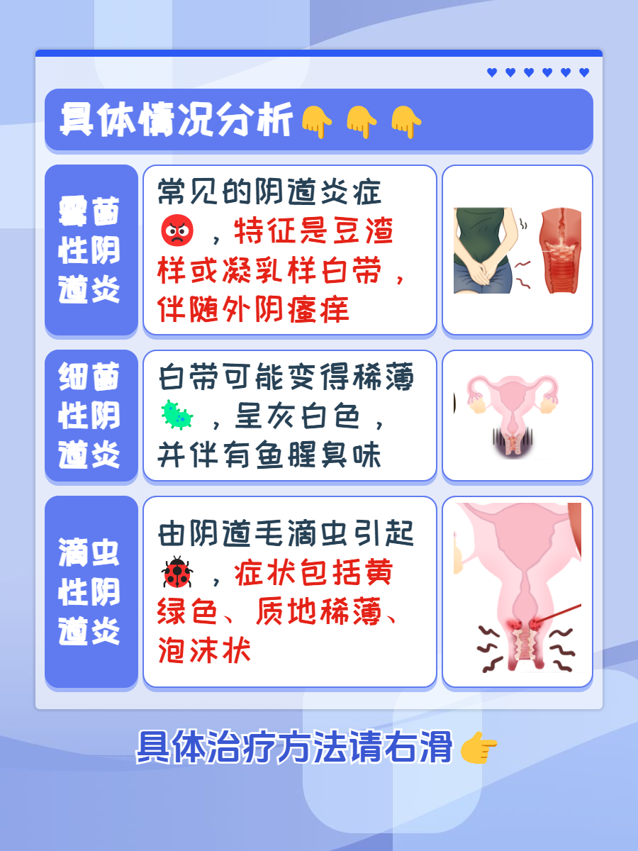 白带多是什么原因呢