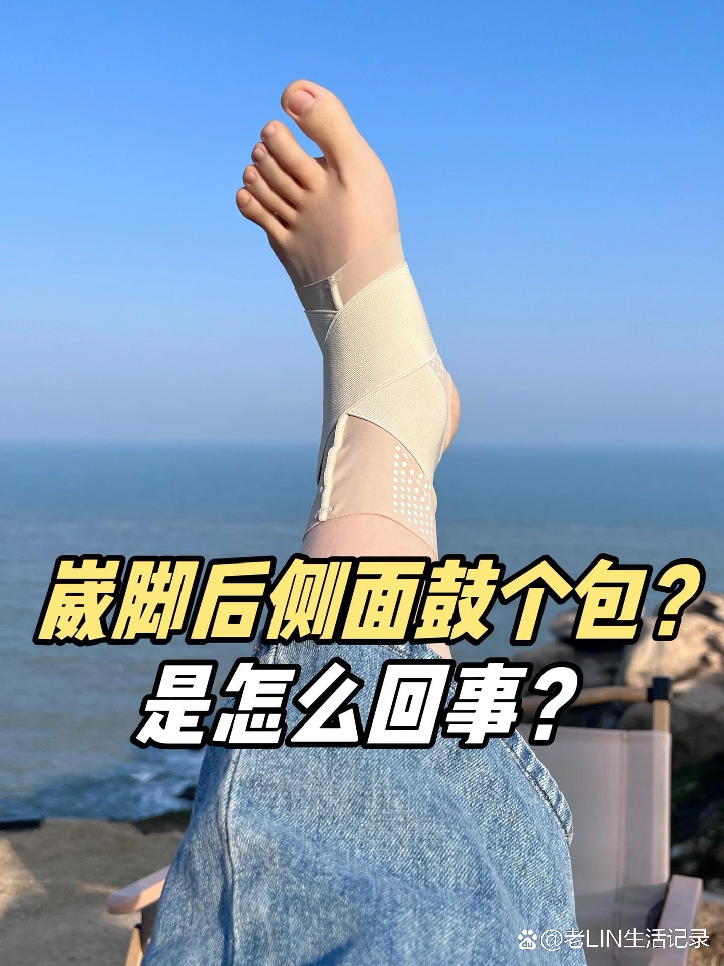 脚崴了肿了怎么消肿?