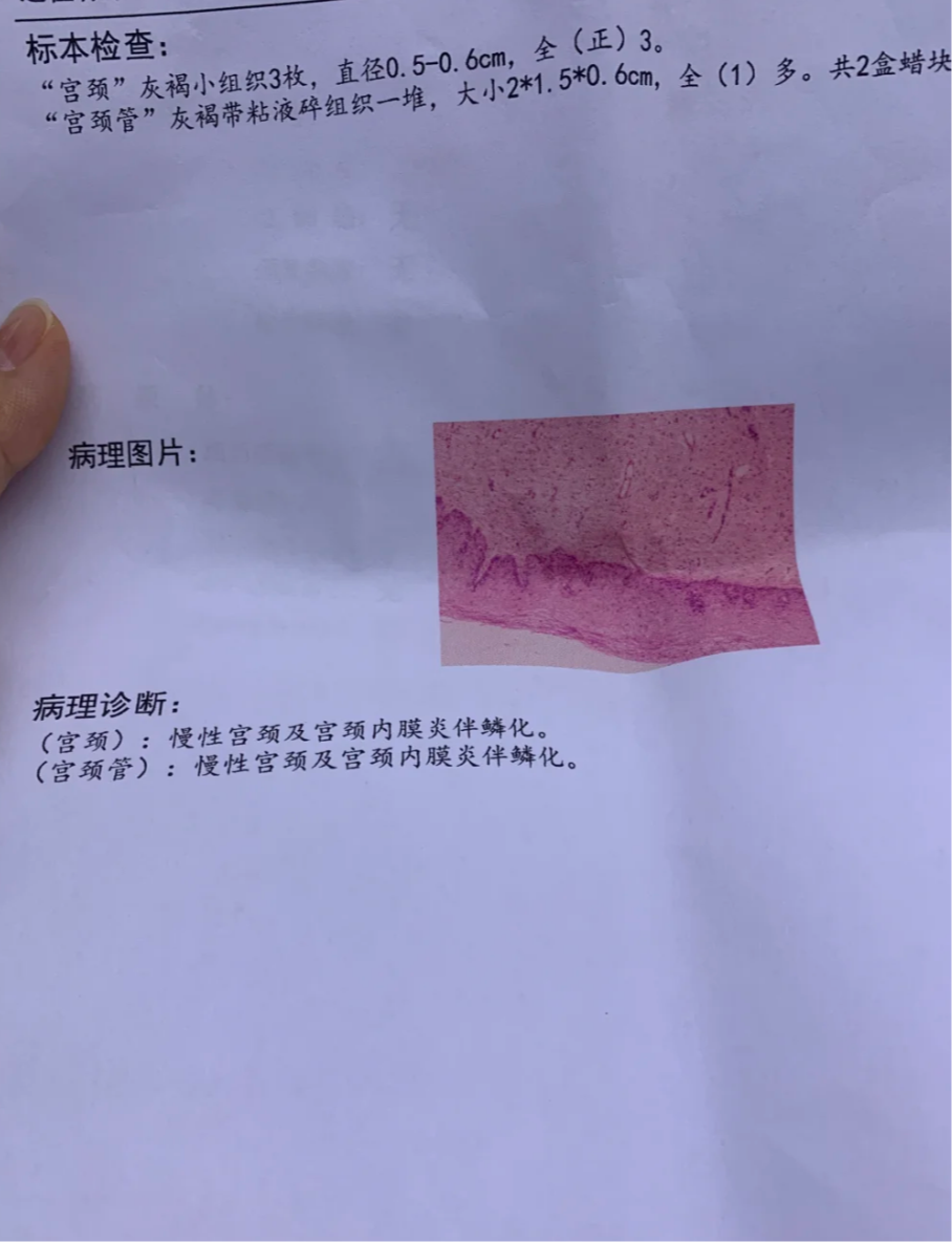 过氧化氢阳性+是什么意思?