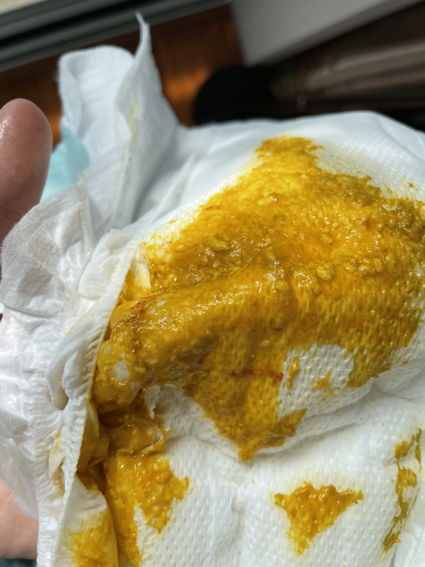 三个月宝宝大便有血丝