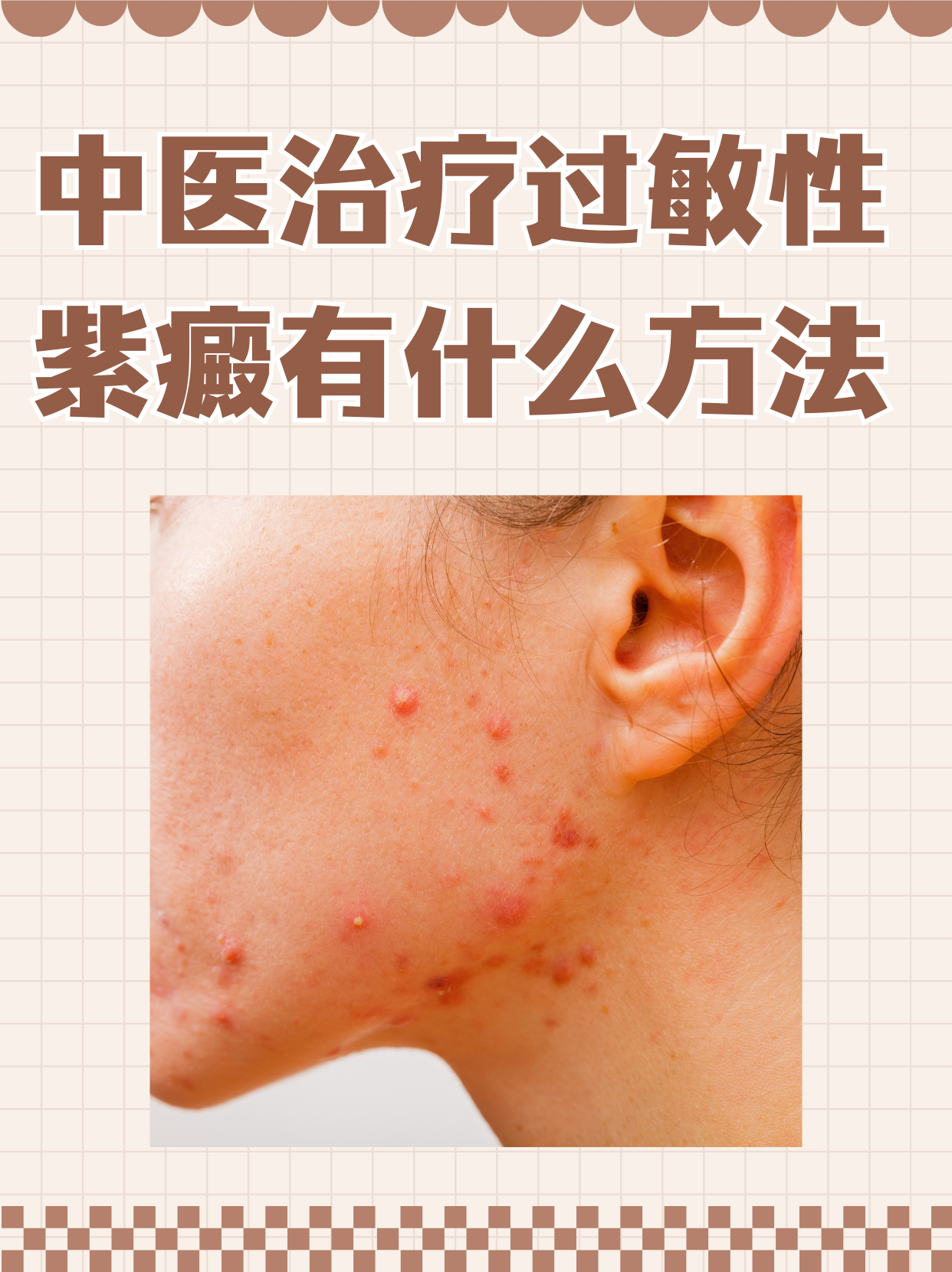 血小板性紫癜会自愈吗