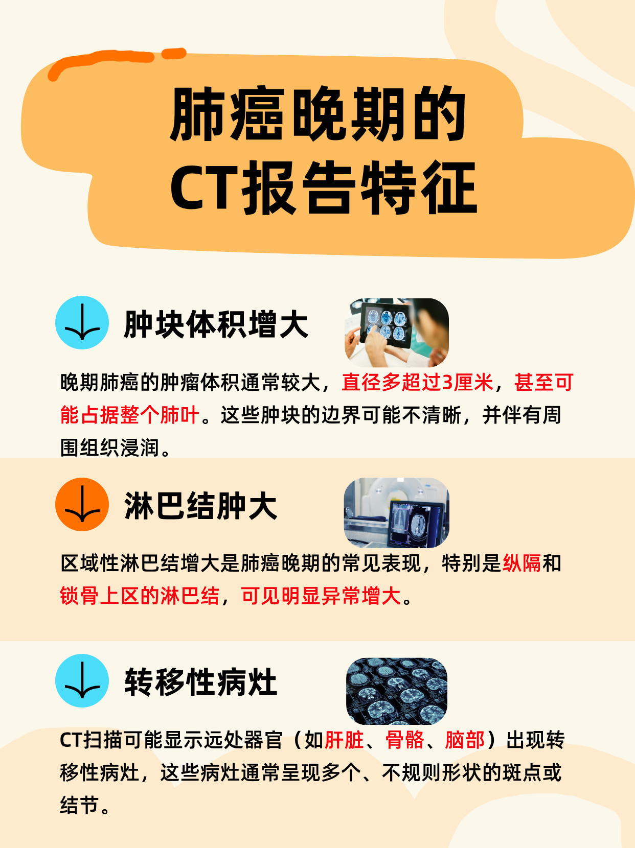 肺部CT能检查出肺癌吗