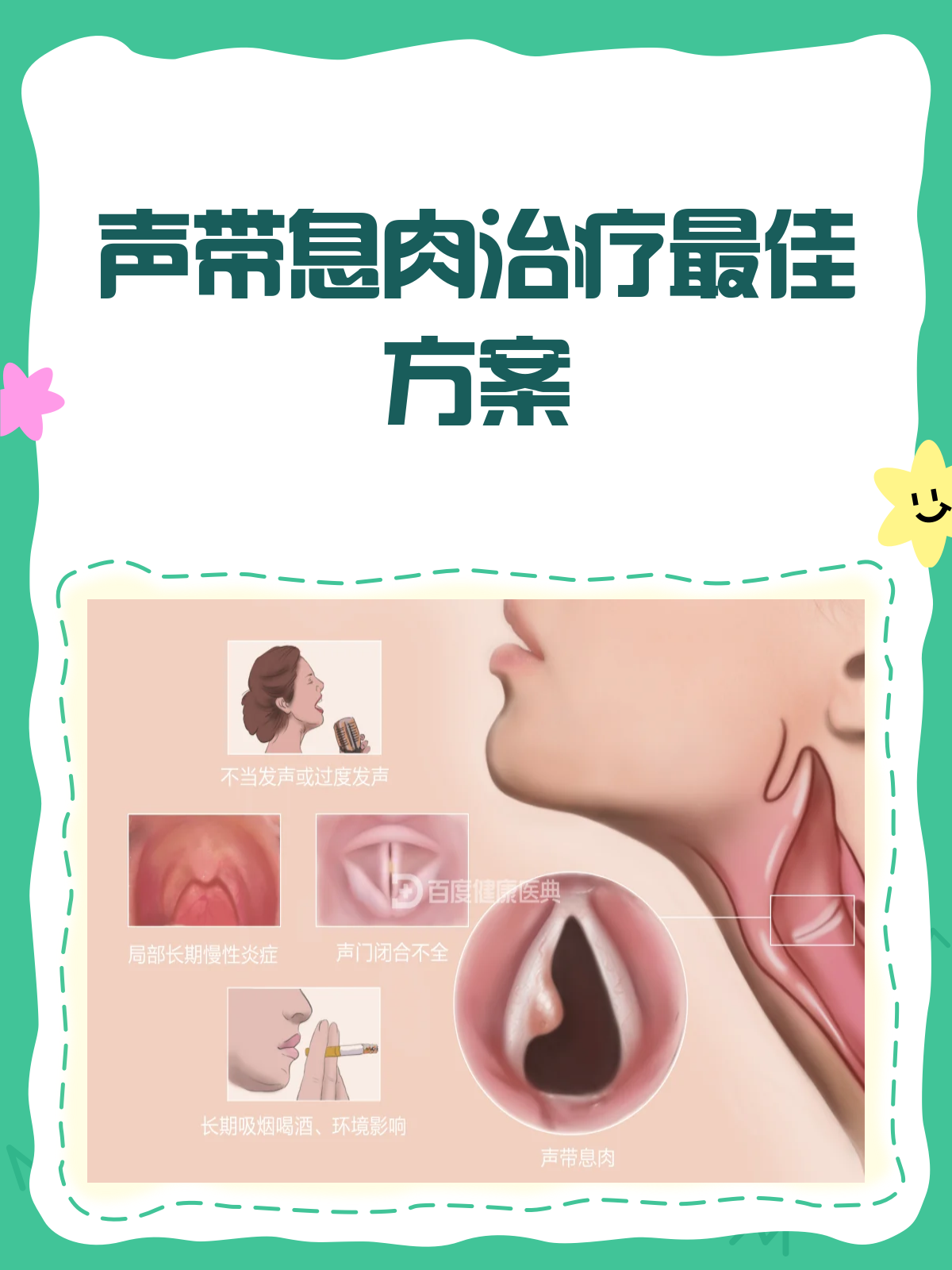 喉结上方有硬块,影响声音怎么办