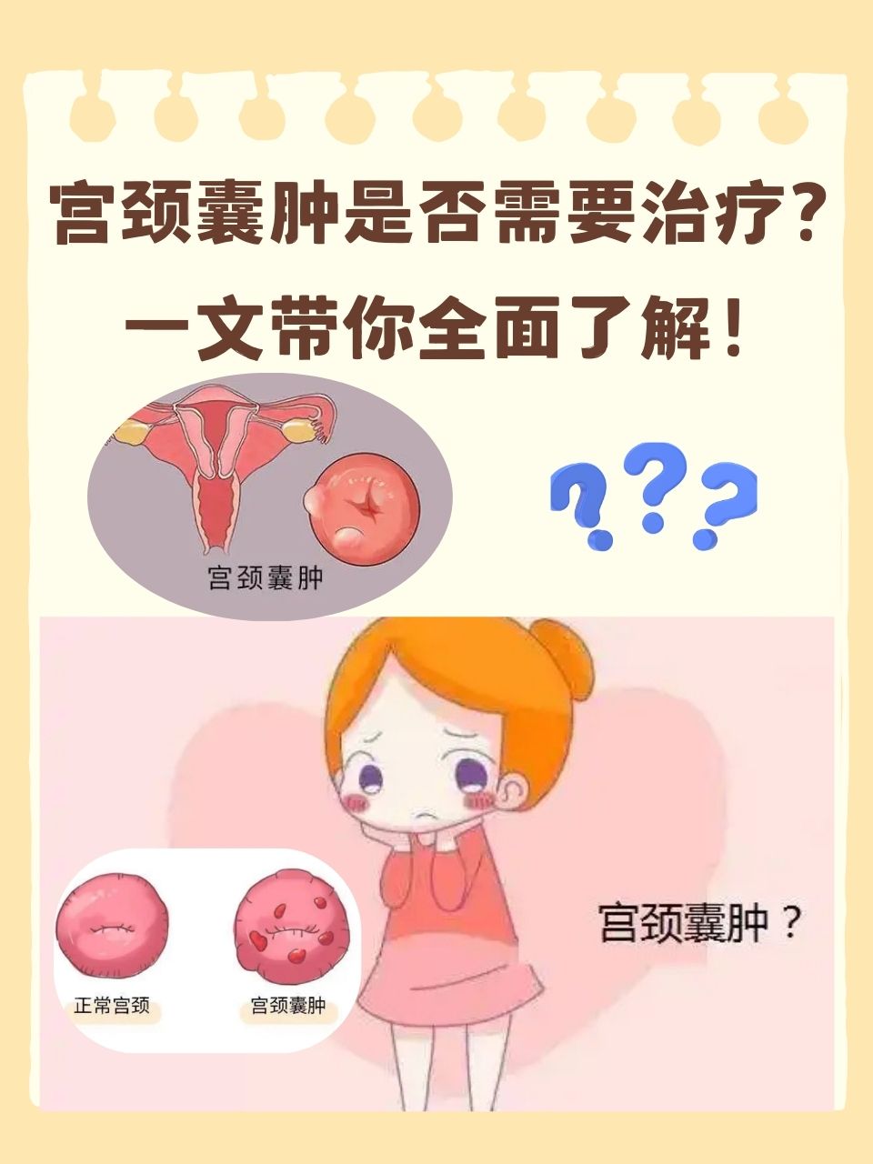 妇科囊肿怎么治疗