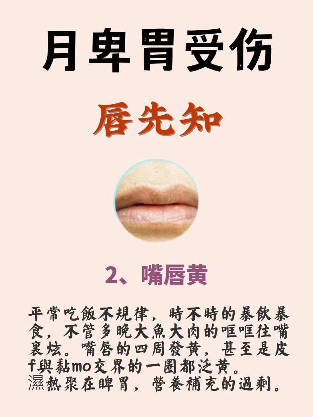 女性嘴唇发白是什么原因呢