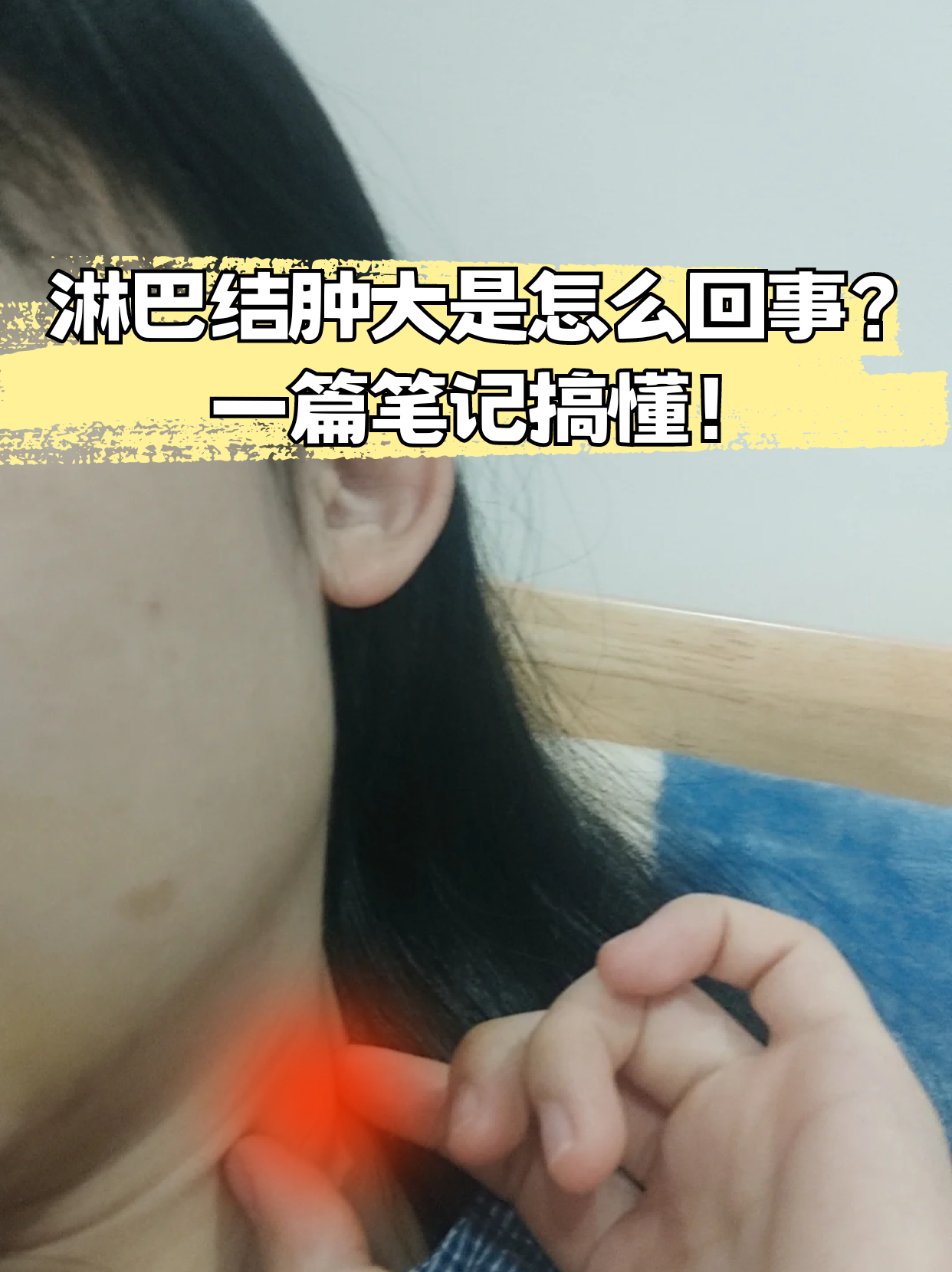 脖子左侧有个肿块,是怎么回事