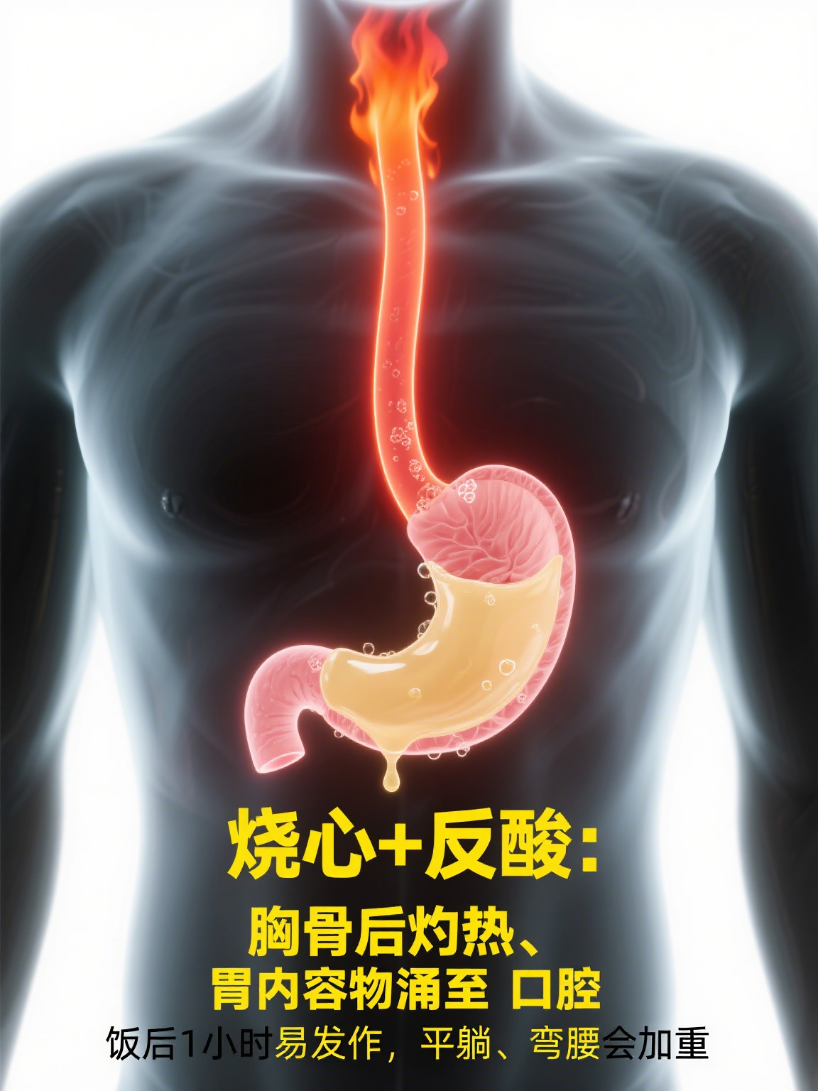 胃食道反流的初期症状有哪些