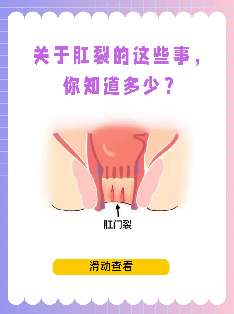 大便时肛门撕裂般的疼什么原因