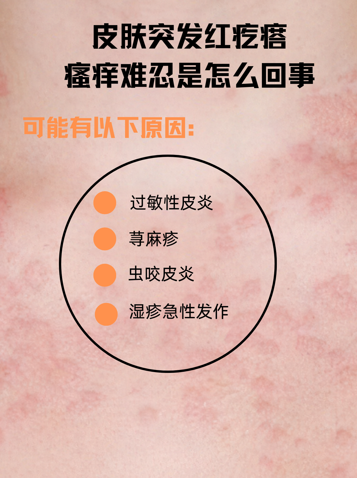 太阳晒后皮肤起疙瘩,痒怎么办?