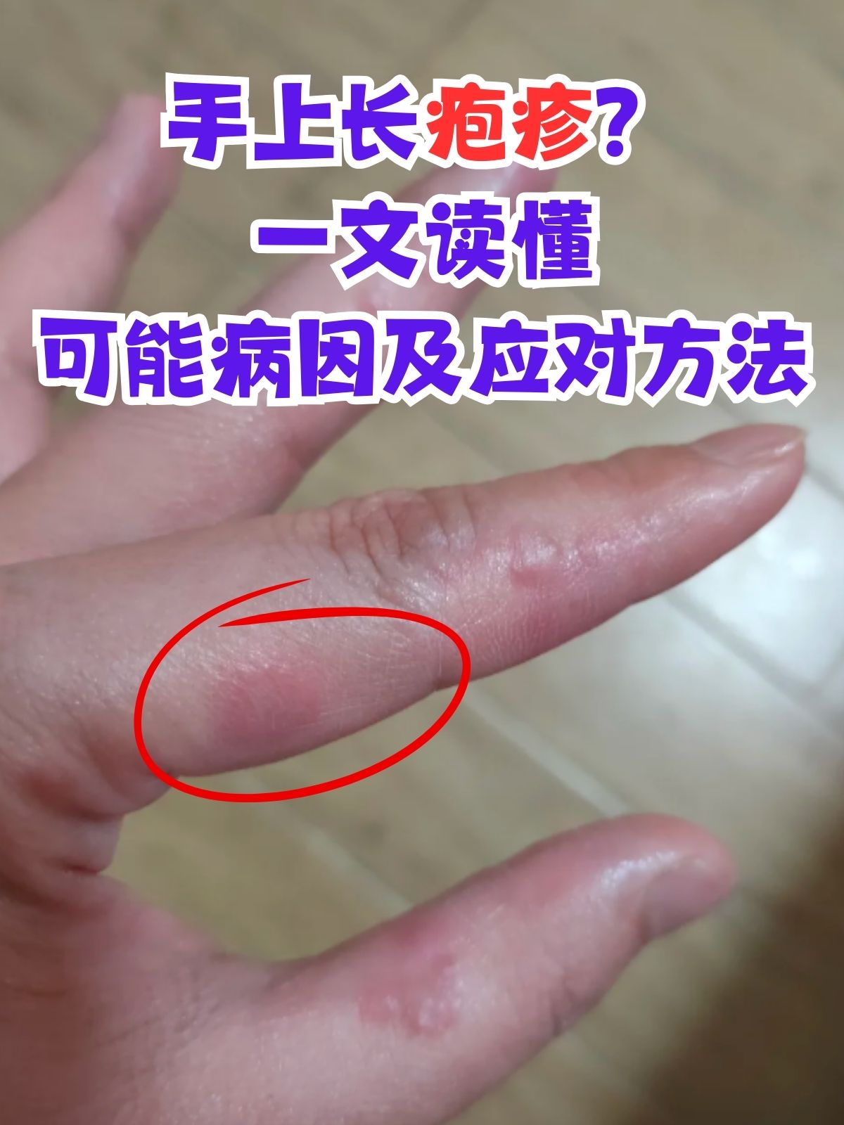 手上起红点,很痒怎么回事?