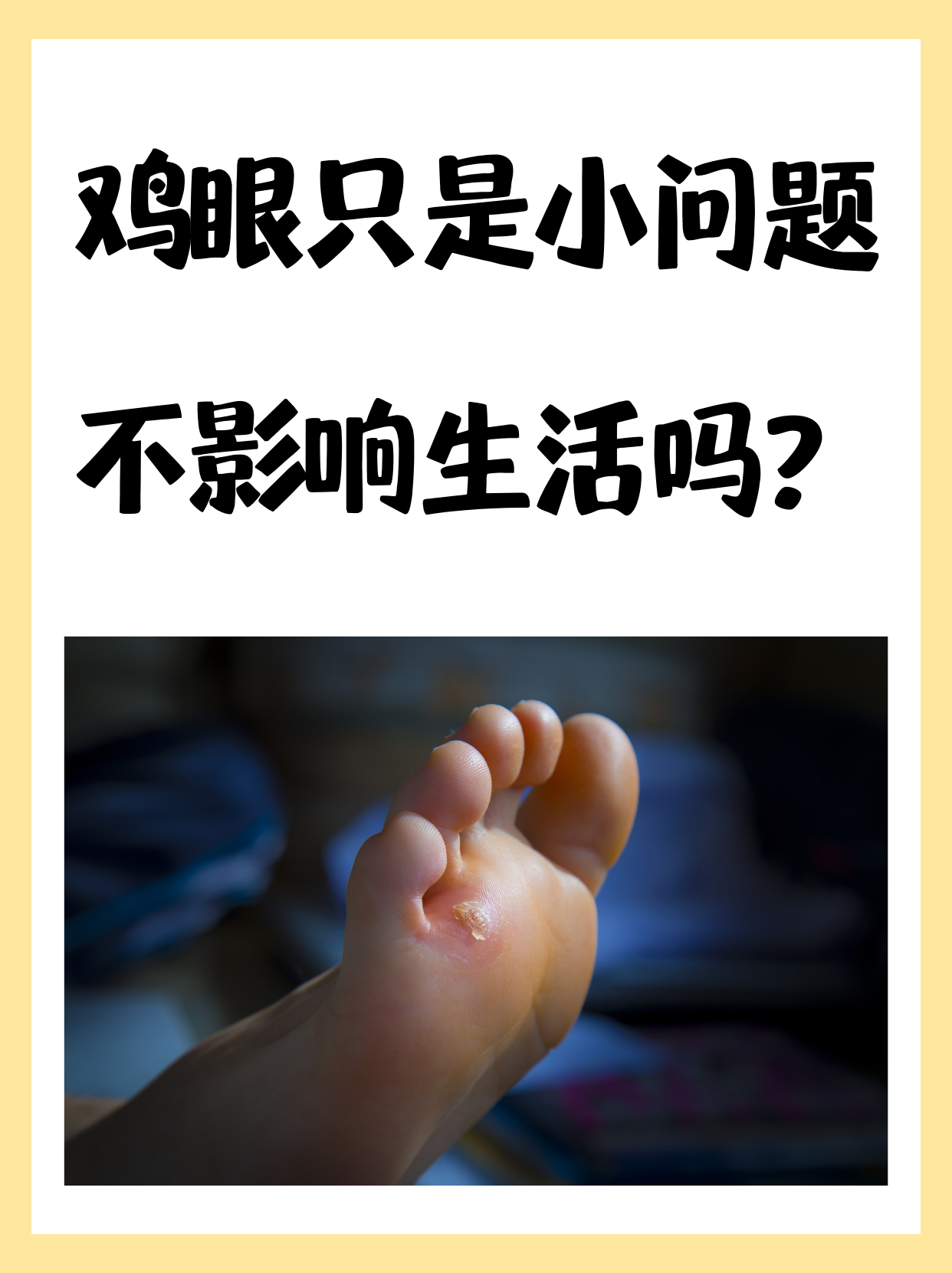 得了鸡眼对人有什么危害