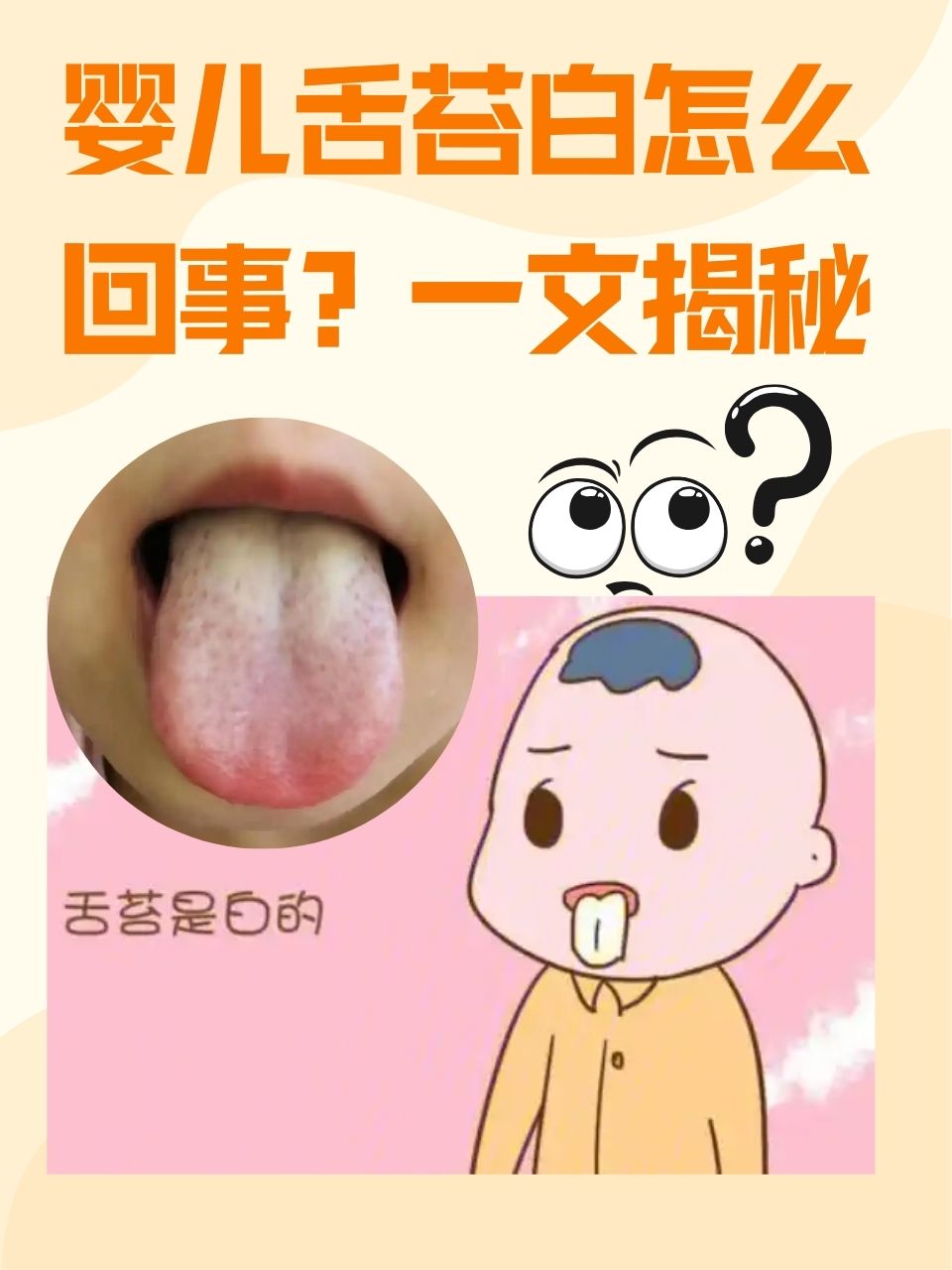 新生儿为什么总吐舌头?