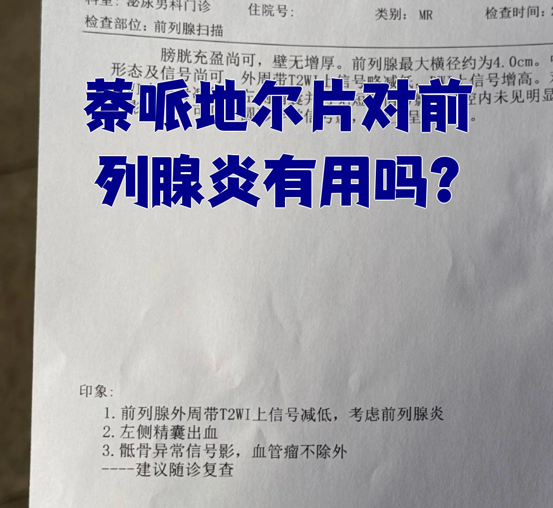 前列腺肥大应该吃什么药