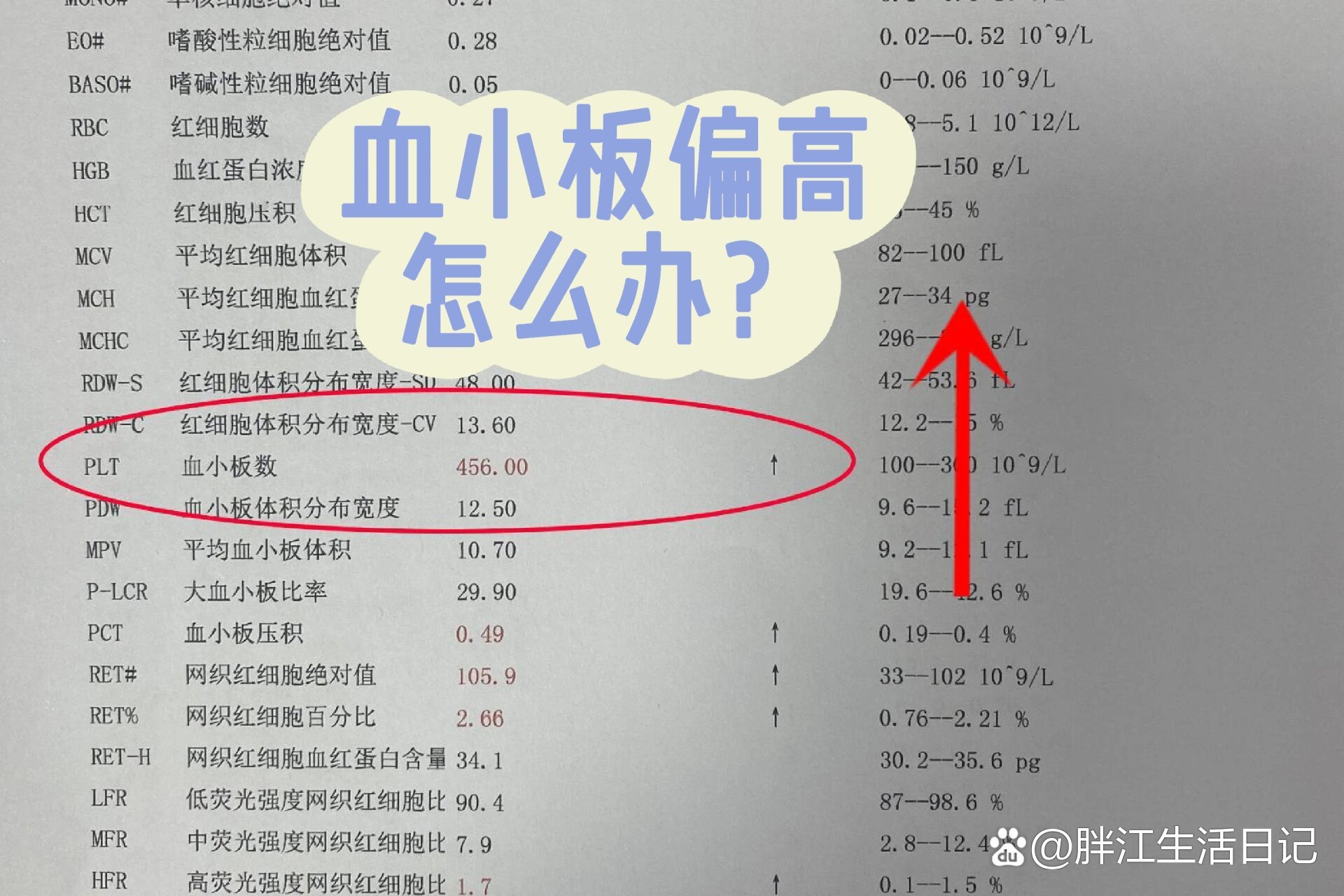 血小板体积分布宽度偏高是什么意思