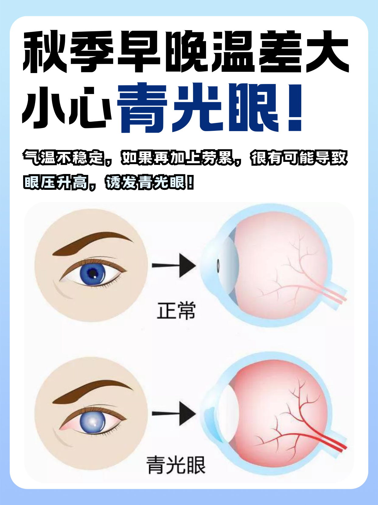 眼睛闪光是什么引起的?