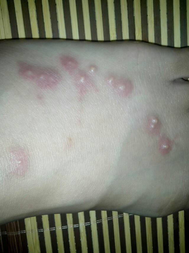 什么叫冶游史我在网页上了解一些关于性病方面的知