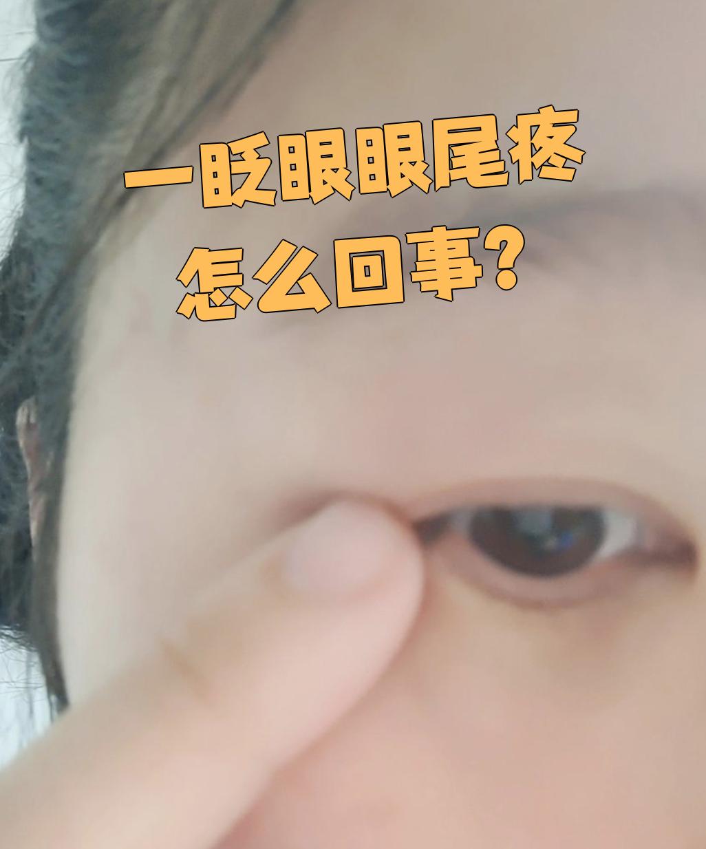 眼睛疼怎么回事