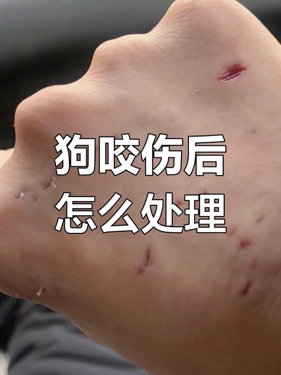 人得狂犬病症状有哪些