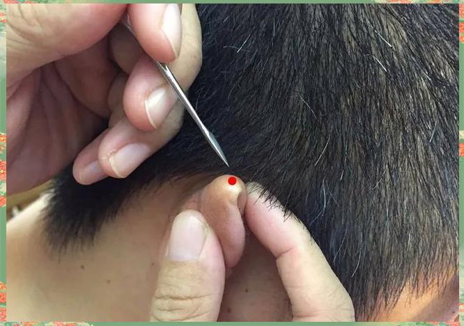 中医急救之法mdash刺激水沟穴