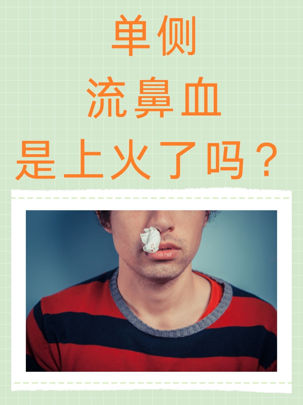 经常流鼻血是为什么