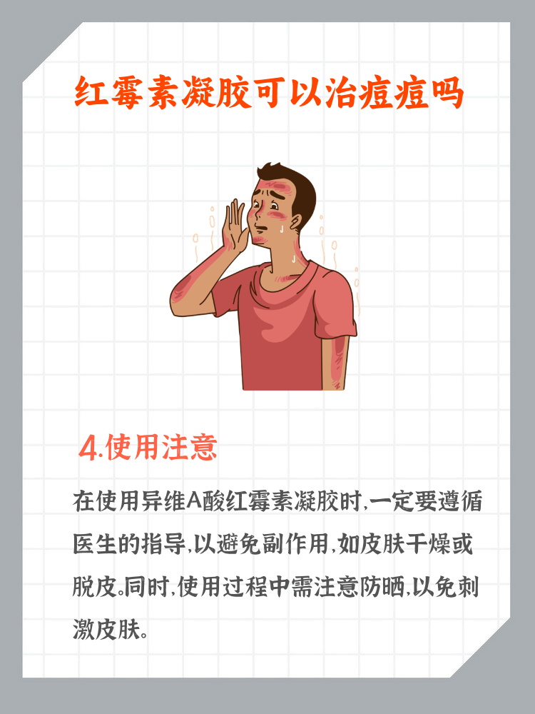 异维A酸凝胶的主治功能是什么呢?