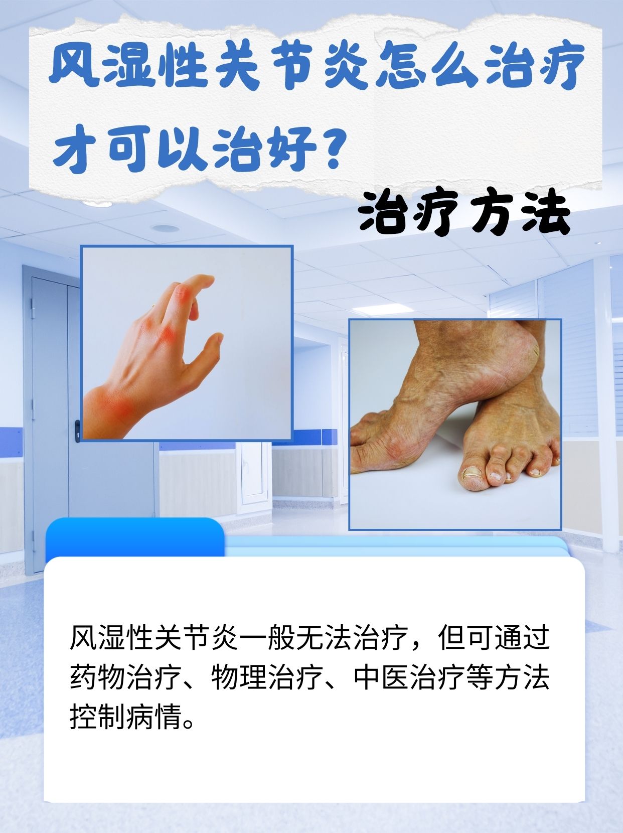 风湿热的治疗方法有哪些?