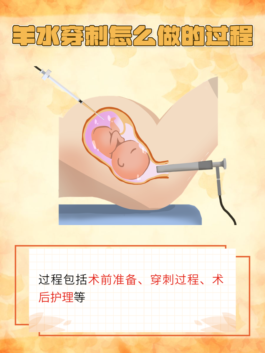 做羊水穿刺费用