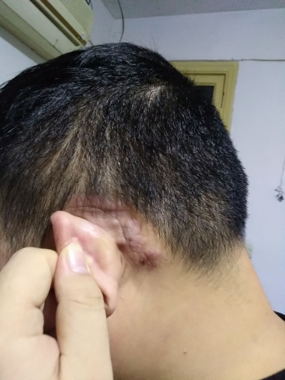 耳朵后边长了个疙瘩是怎么回事