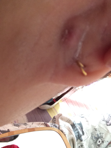 耳朵后边长了个疙瘩是怎么回事