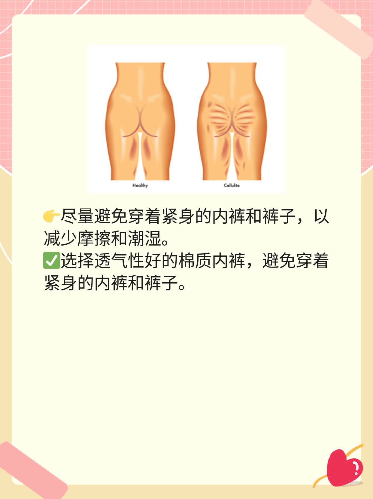 霉菌性阴道炎怎样治疗