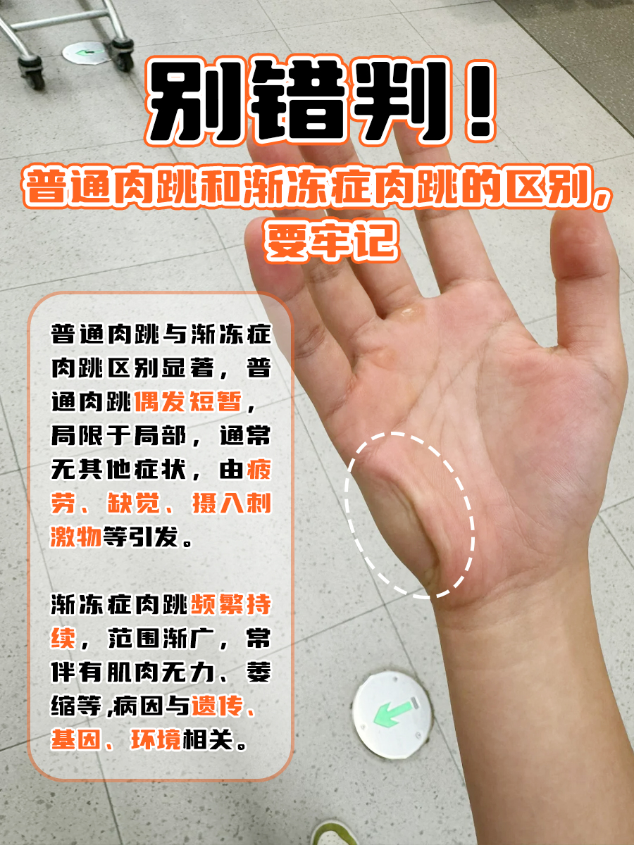 全身肌肉跳动是怎么回事?