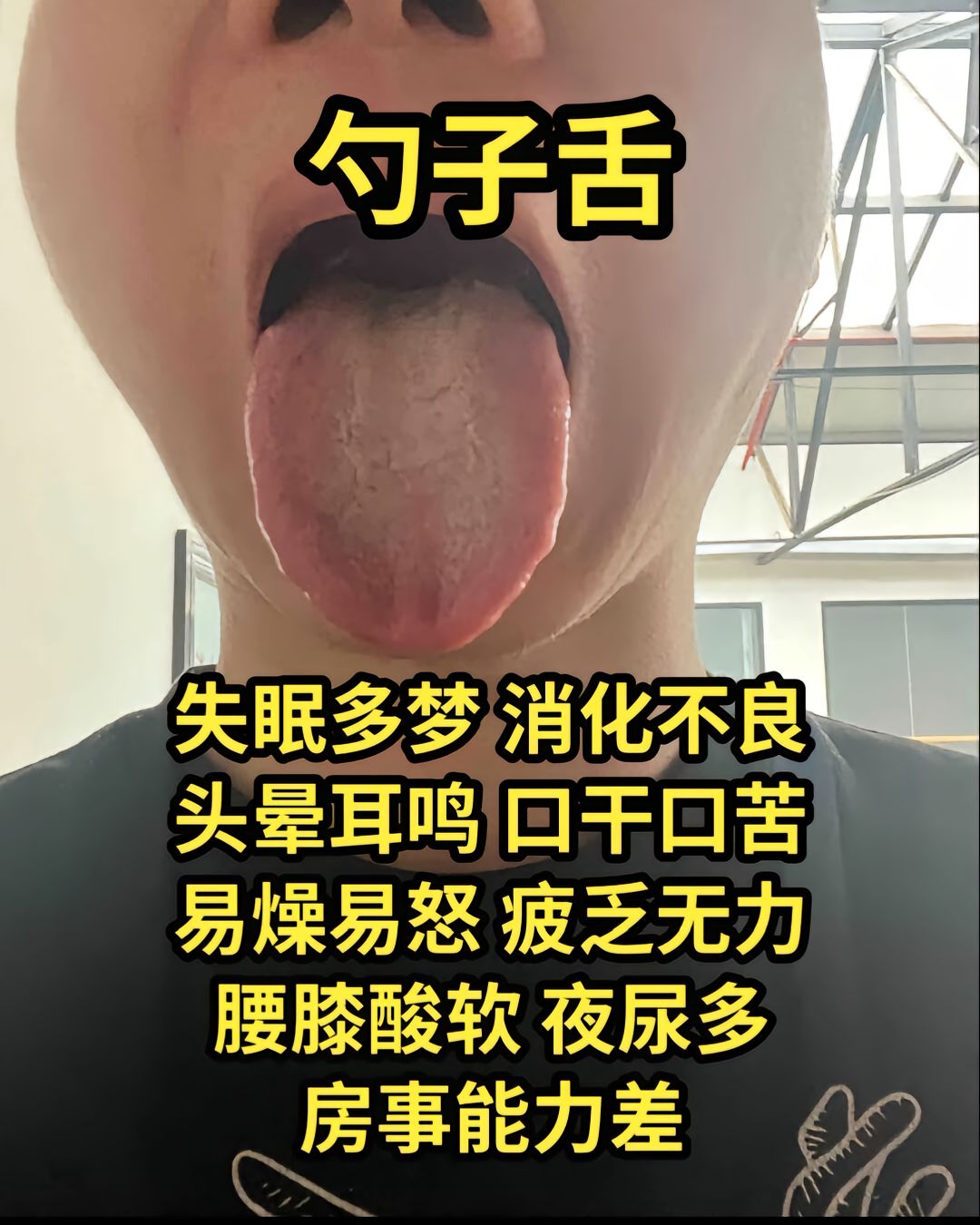 舌苔发黄厚是怎么回事啊