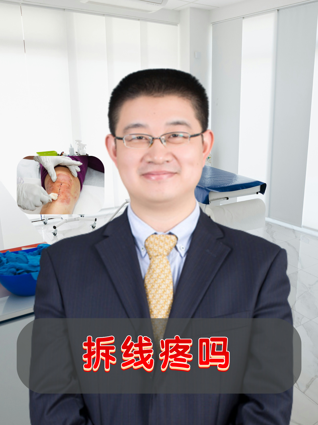 伤口缝针拆线最佳时间时间