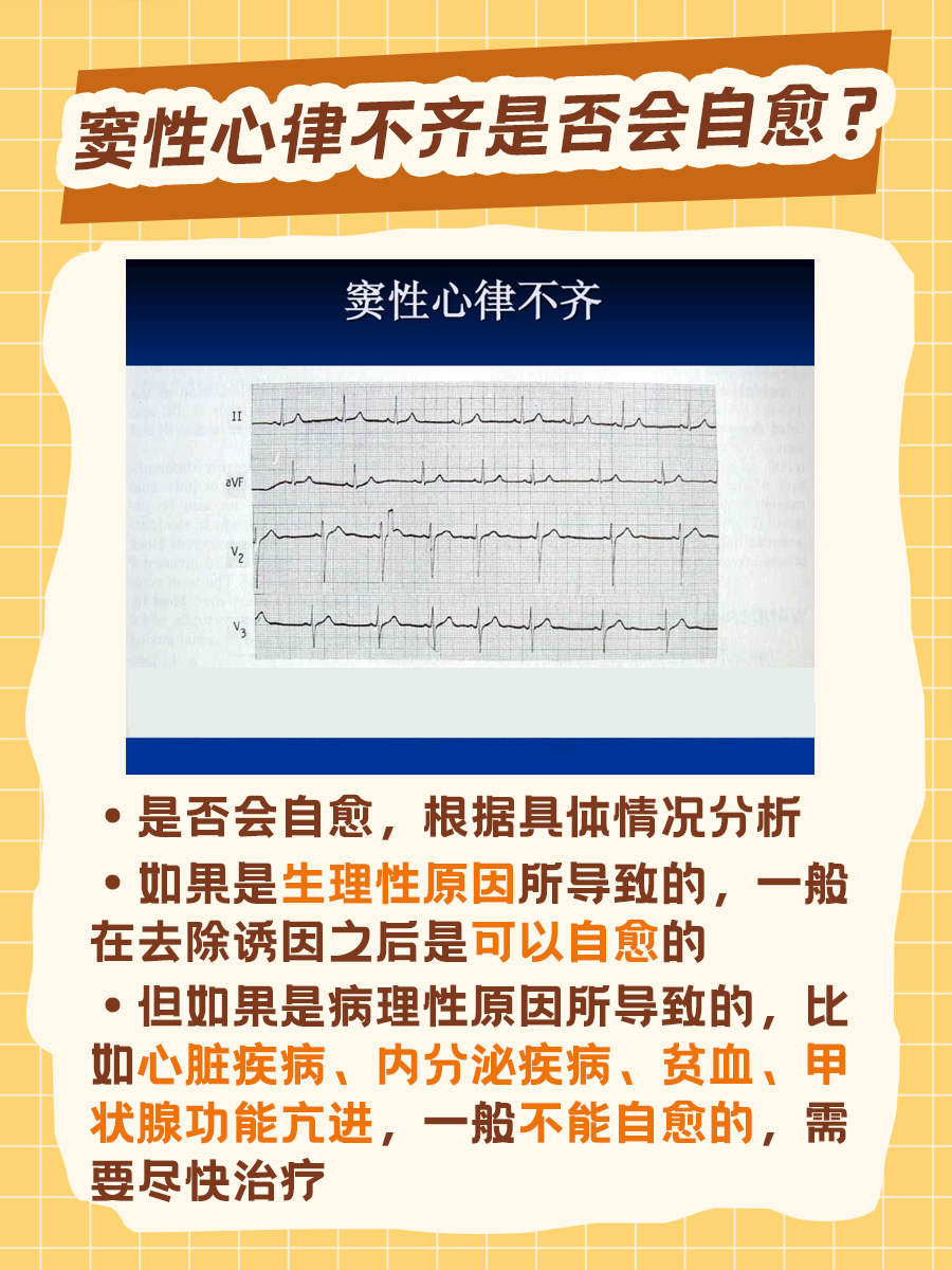 孕妇患窦性心律不齐怎么办