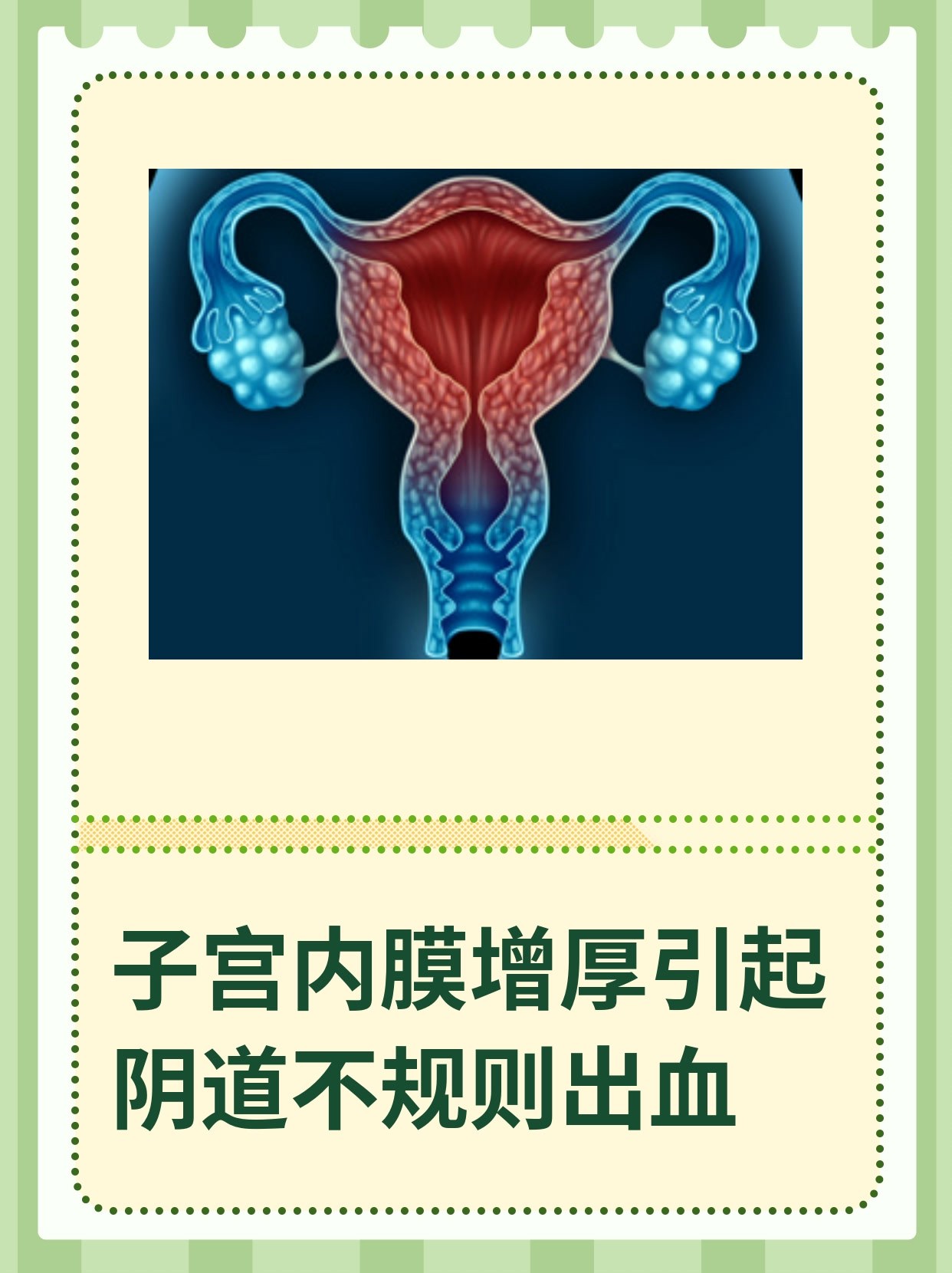 子宫内膜厚必须刮宫吗