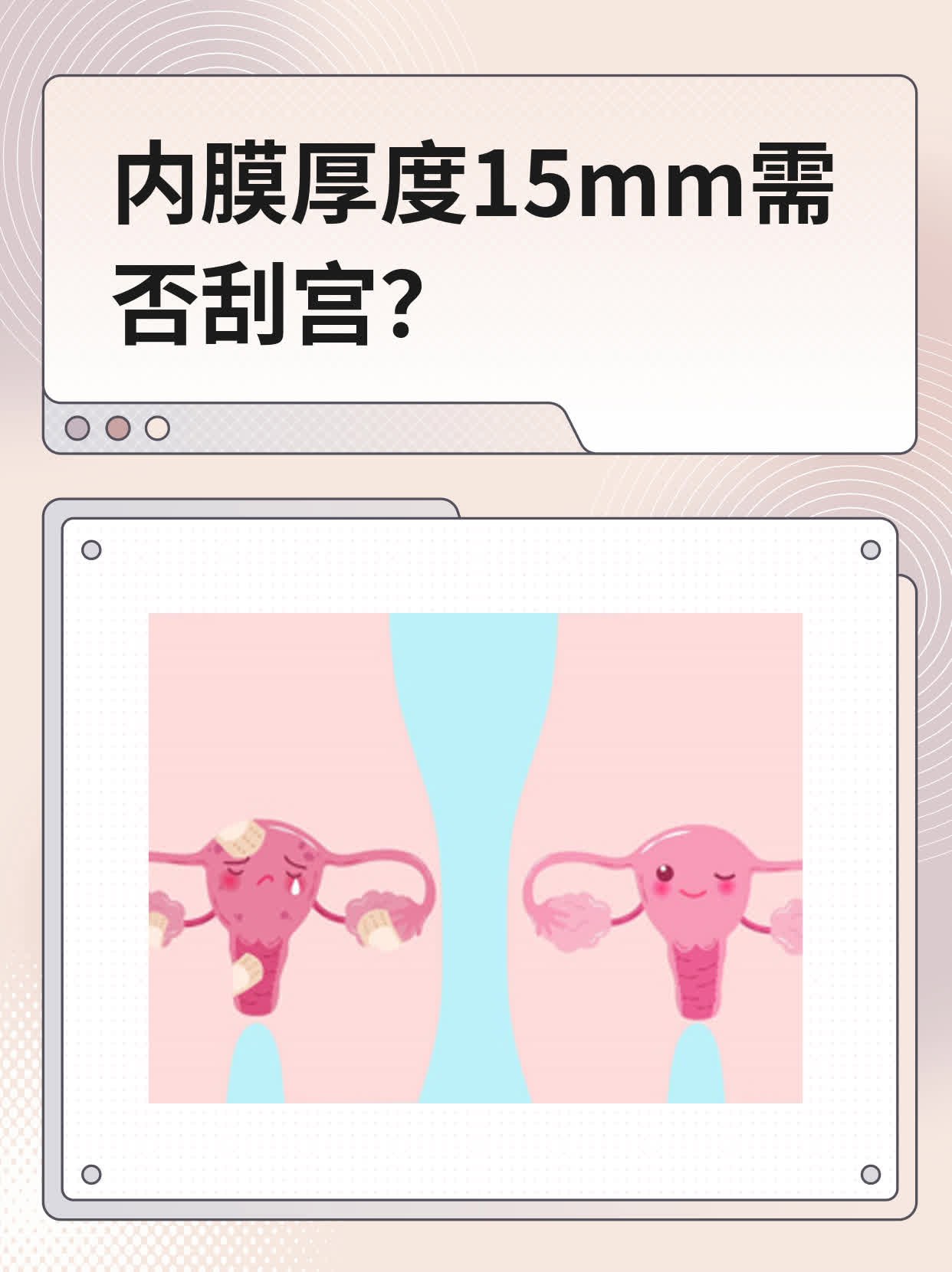 子宫内膜厚必须刮宫吗