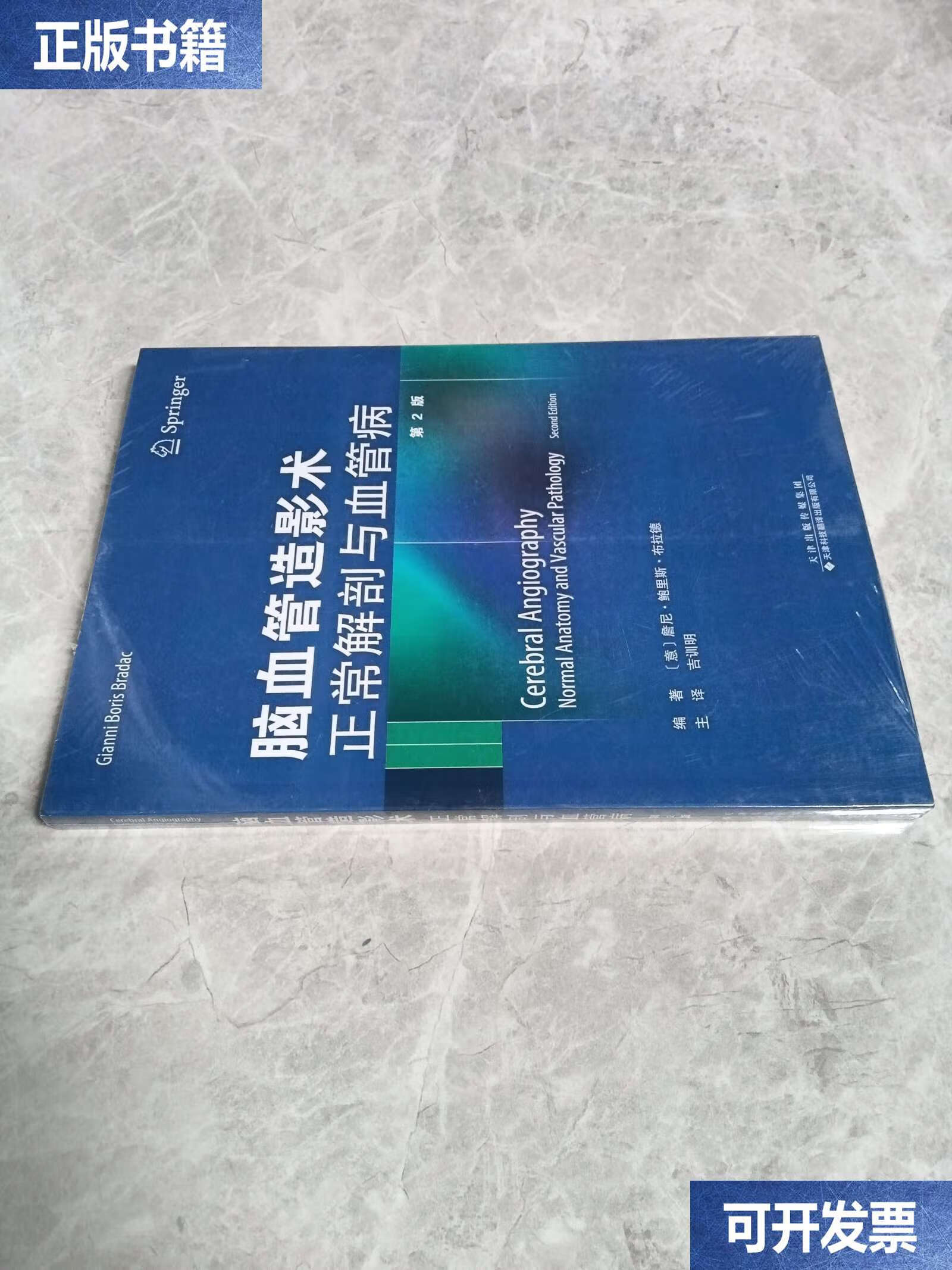 脑血管造影要多少钱