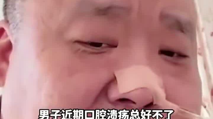 吃槟榔多了把舌头吃坏了