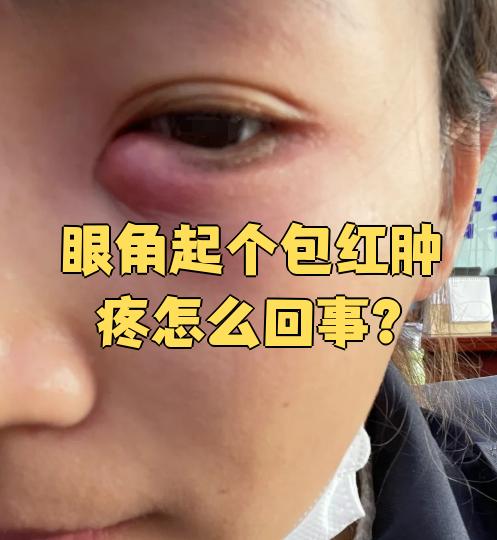 上眼角肿了怎么回事