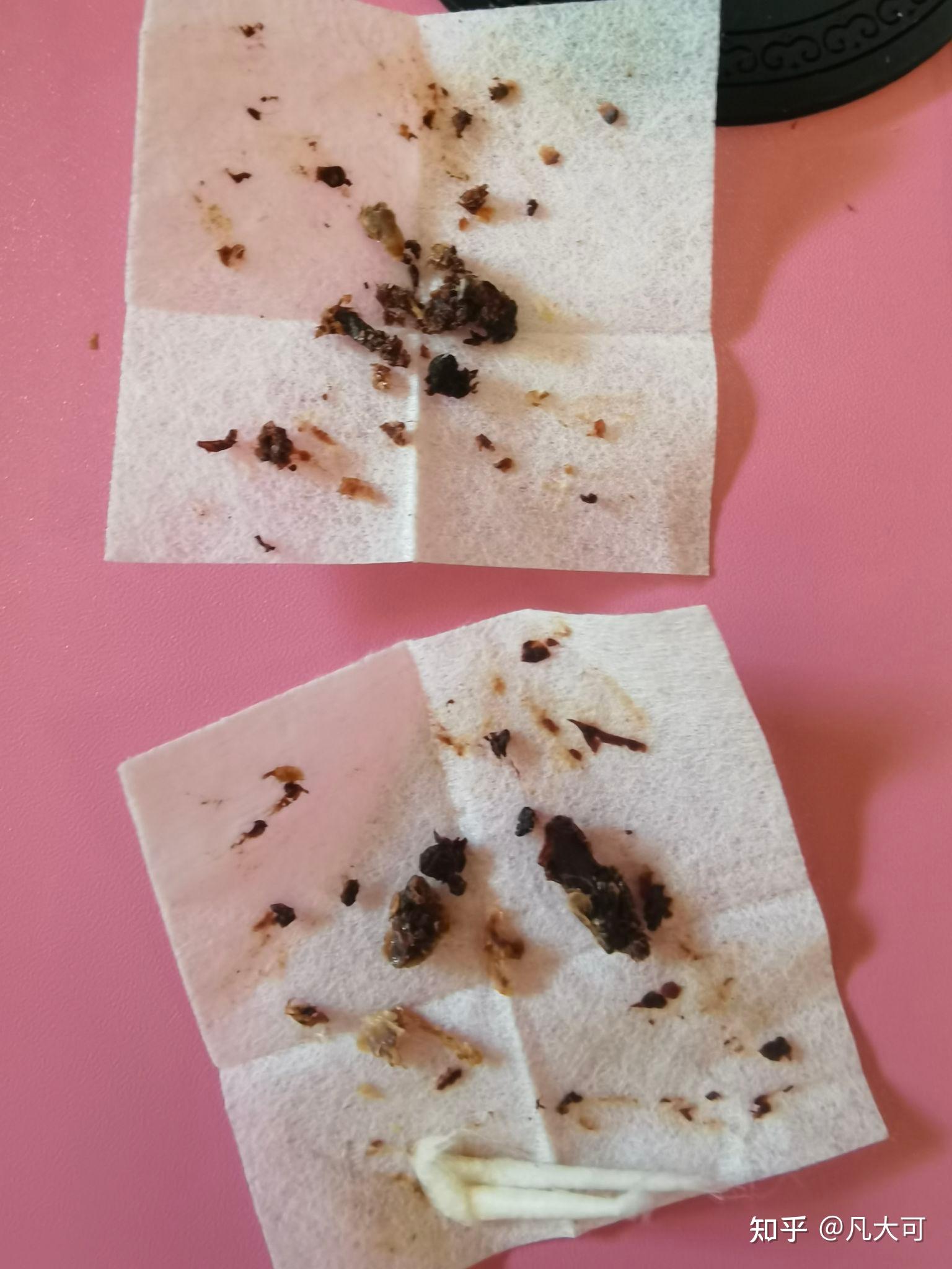 挖下来的鼻屎上有血怎么回事